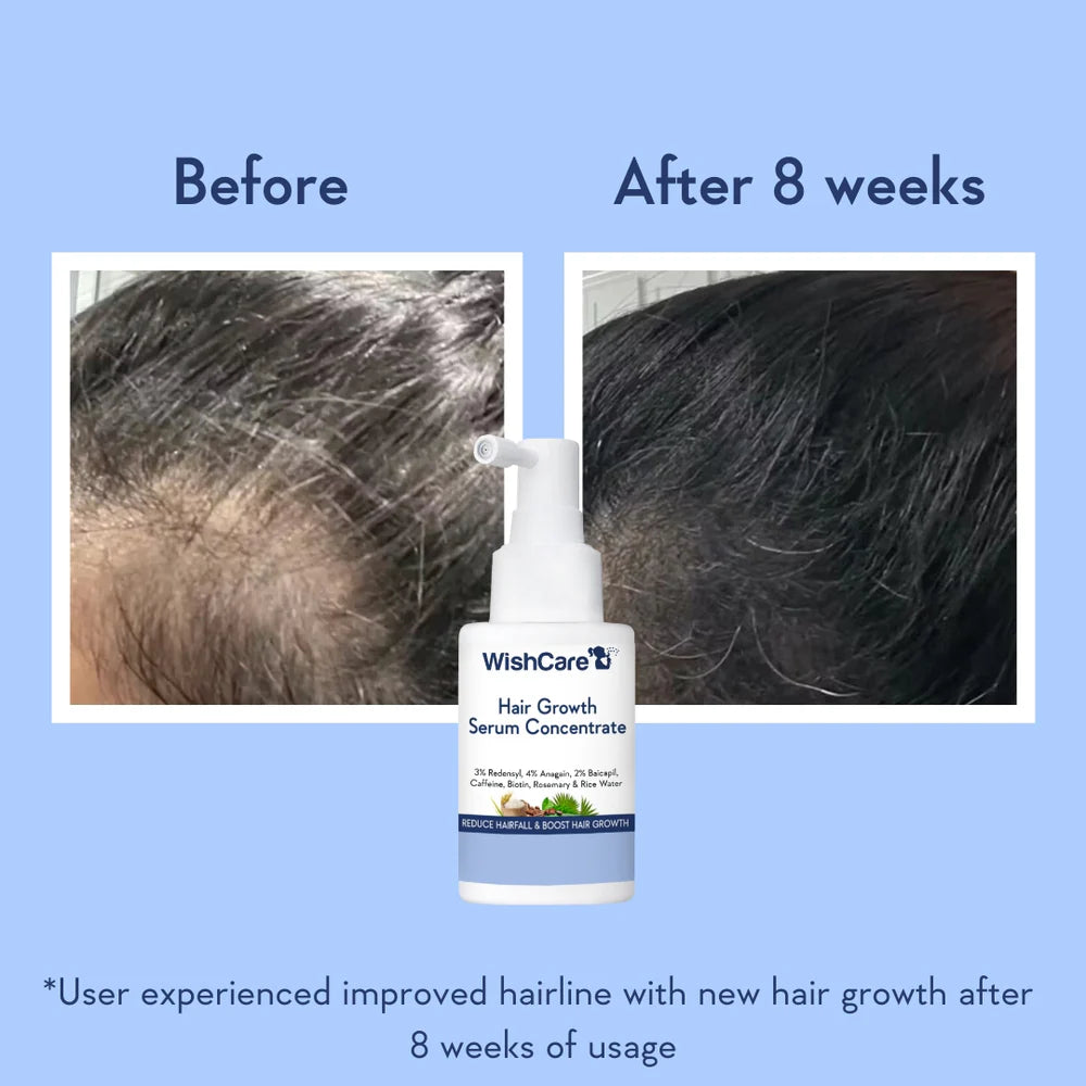 WishCare Hair Growth Serum