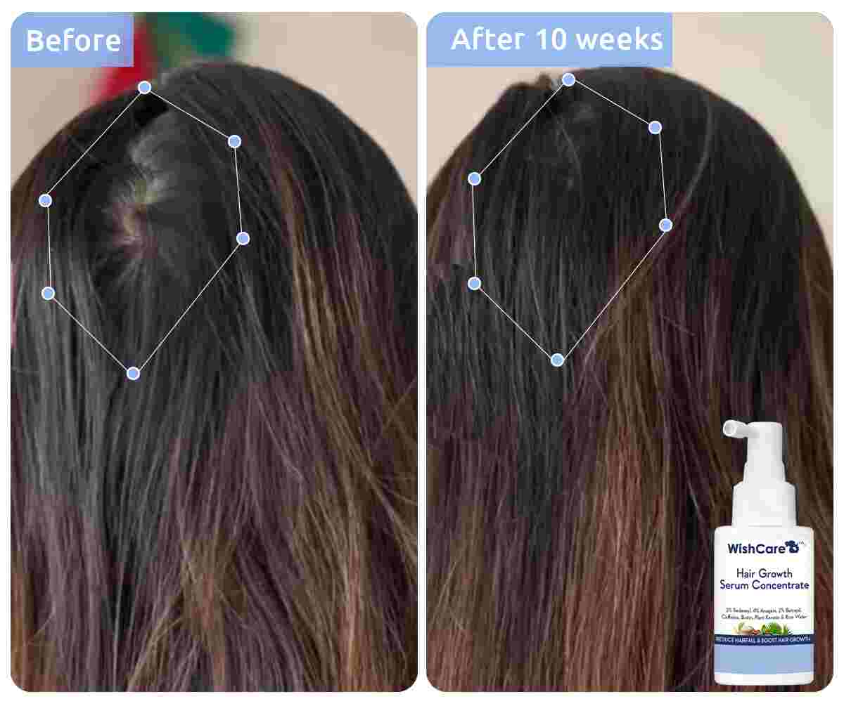 WishCare Hair Growth Serum