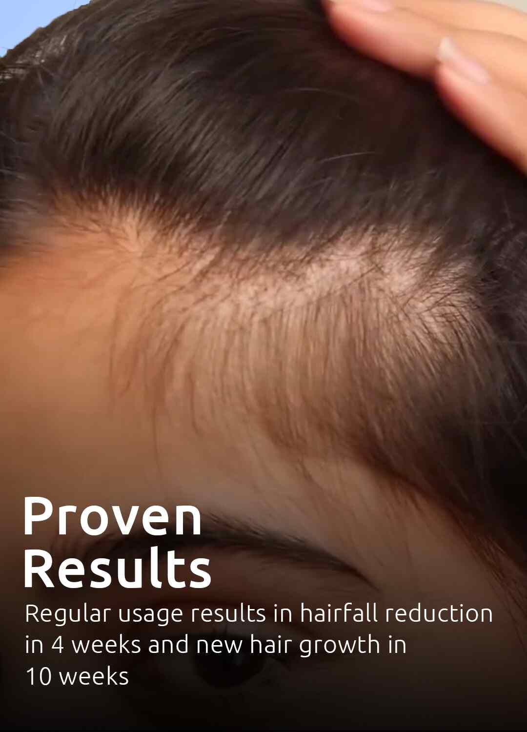 WishCare Hair Growth Serum