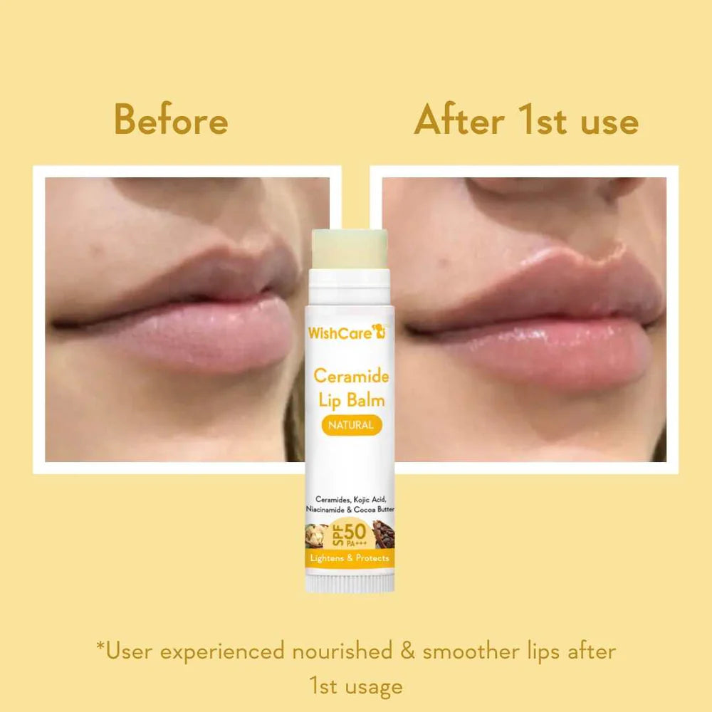 Buy Original WishCare Ceramide Lip Balm In Bangladesh