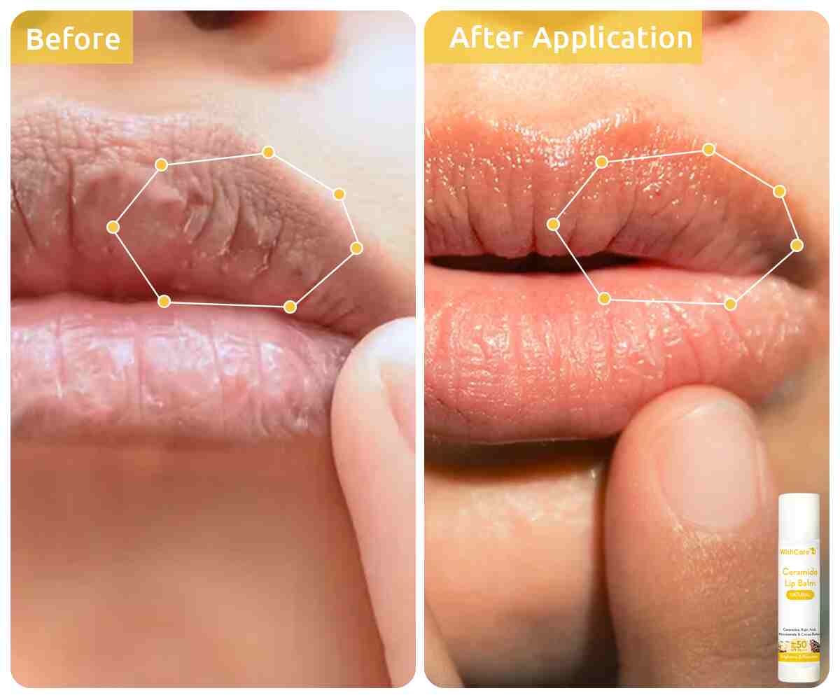 Buy WishCare Ceramide Lip Balm